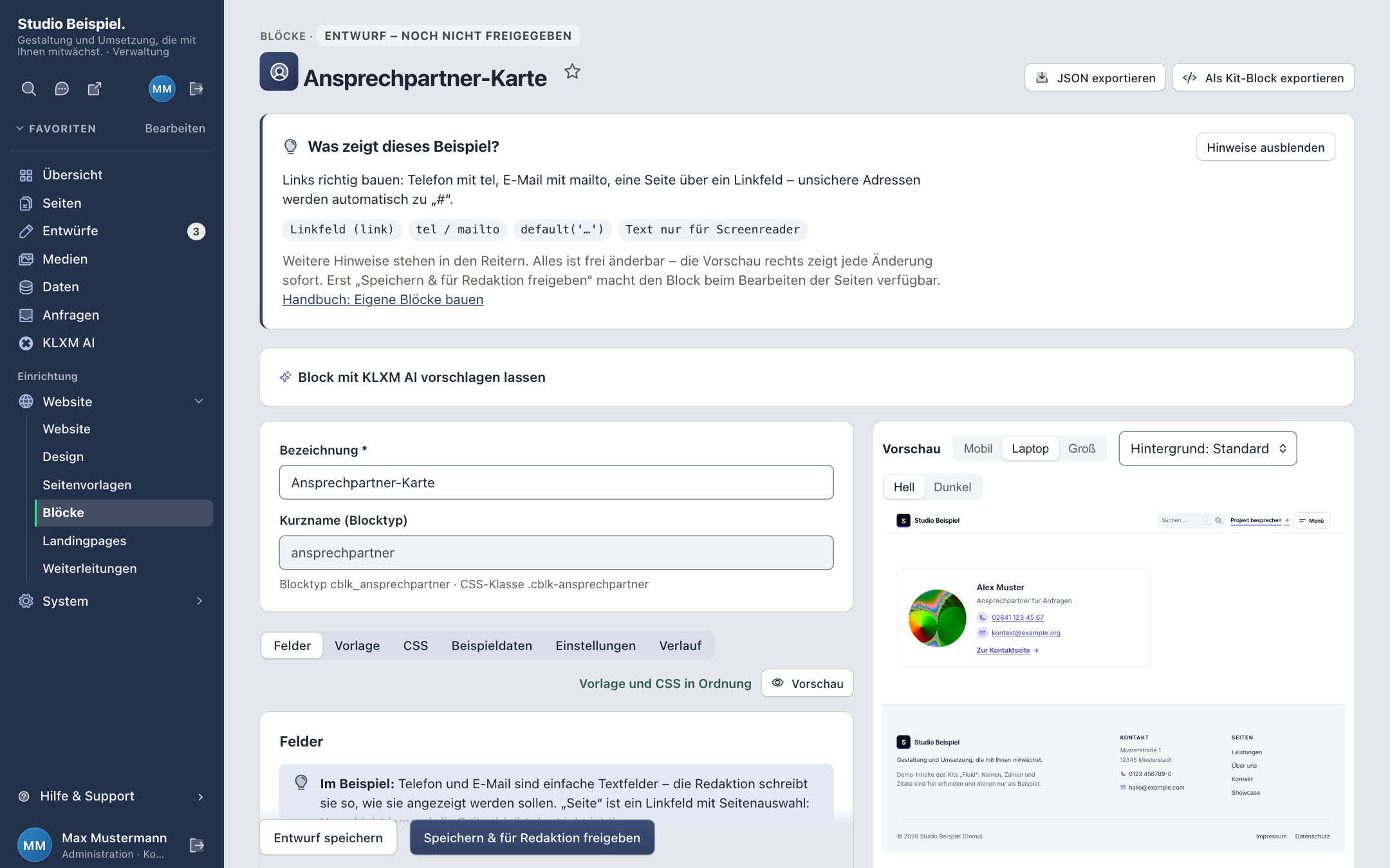 Block-Baukasten „Beispiel Team-Karte“: Felder links, Live-Vorschau mit drei Karten rechts